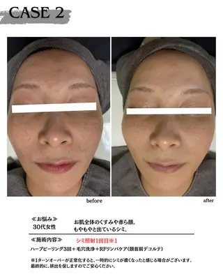 素肌育成・シミケア専門サロン美潤-miulu-所属・【医療提携サロン】 【シミケア専門】のエステ・リラクイメージ