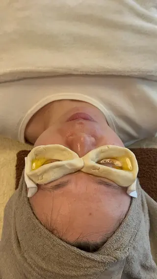 鍼灸•マッサージサロンCalfa所属・《美肌･小顔》美容鍼 ＆マッサージ＊MEIのエステ・リラクイメージ