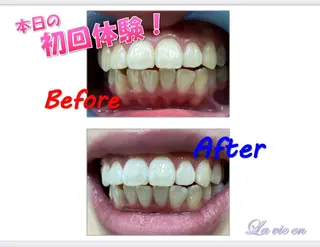 セルフホワイトニングサロン　ラヴィアン所属・ホワイトニングサロン La vie enのその他イメージ