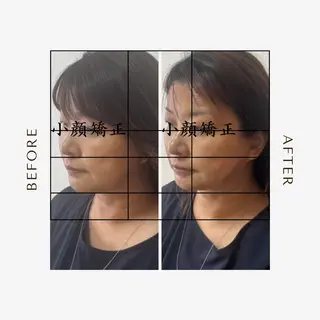 Amaranth所属・Lupinus 小顔矯正のエステ・リラクイメージ