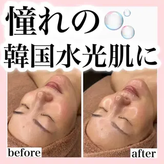 ハーブピーリング/ ララピール専門店のエステ・リラクイメージ