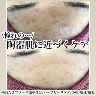 LILIANA所属・LILIANA ☆YURIのエステ・リラクイメージ