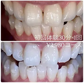 メンズ ホワイトニングルーム　川崎店所属・ホワイトニング ルーム　川崎店のその他イメージ