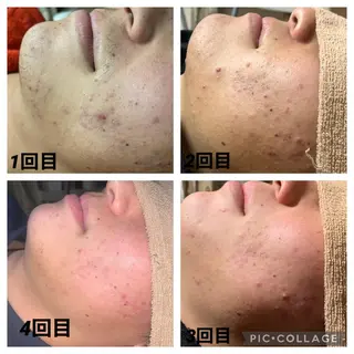 Shelly Graceのエステ・リラクイメージ