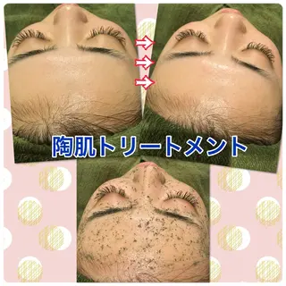 【リベルハーブピーリング認定店】敏感肌・美白脱毛専門店Dione立川店所属・Dione 立川店のエステ・リラクイメージ