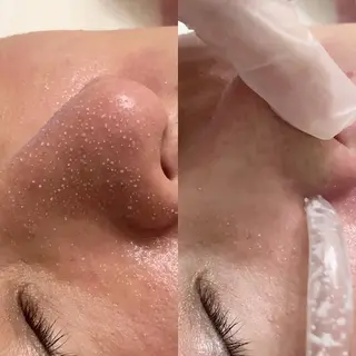 Rifuro 勝田台エステ所属・Rifuro勝田台 ララピール・毛穴洗浄のエステ・リラクイメージ