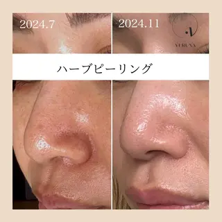 ピーリング専門店 Belluteのエステ・リラクイメージ