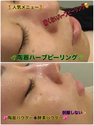 【リベルハーブピーリング認定店】敏感肌・美白脱毛専門店Dione立川店所属・Dione 立川店のエステ・リラクイメージ