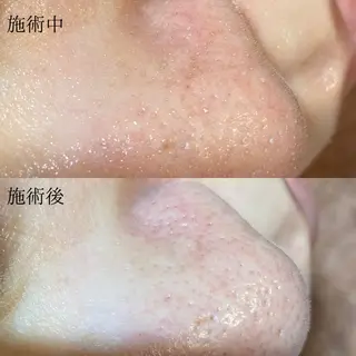 荒井 益美のエステ・リラクイメージ