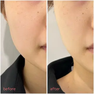 MORE BEAUTY ESTHE 本通り店所属・more ‎‪𓍯 ‬のエステ・リラクイメージ