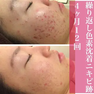 ミディアム カラー パーマ ヘアアレンジ メンズ キッズ ネイル マツエク・マツパ ニキビ・肌質改善専門 ♡人生が変わるサロンのエステ・リラクイメージ