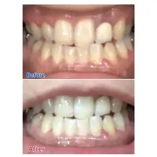 M渋谷店所属・M渋谷 ホワイトニングのエステ・リラクイメージ