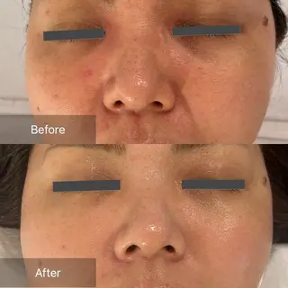 mine.mマインエム所属・mine.mi マインエムのエステ・リラクイメージ