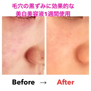 Bène Soin du Esthétique所属・逵中 元香のエステ・リラクイメージ