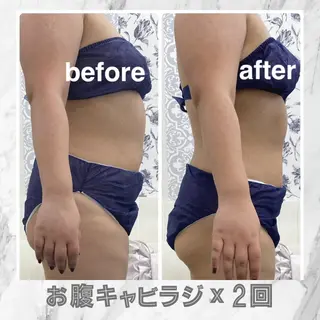 小顔痩身HALO 二宮早織のエステ・リラクイメージ