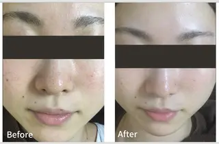 アンジェリック ビーナス　Rinonのエステ・リラクイメージ