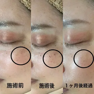 LUMY GRATiAEのエステ・リラクイメージ