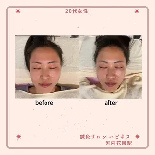 美容鍼サロン ハピネス所属・土手 真矢のその他イメージ