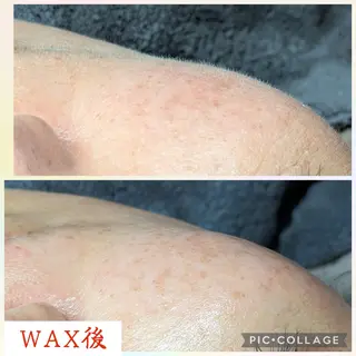 肌質改善プライベートサロンwith U所属・肌質改善サロン with Uのエステ・リラクイメージ