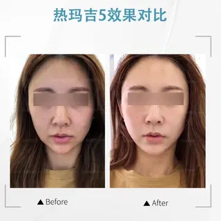 マツエク・マツパ aliaハイフ&水光ジェットサロン所属・aliaハーブ水光店 エステティシャン募集のエステ・リラクイメージ