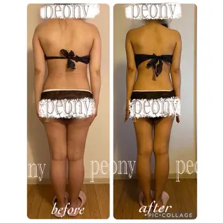 デトックス美容専門サロンｐｅｏｎｙ所属・デトックス美容専門 サロンｐｅｏｎｙのエステ・リラクイメージ