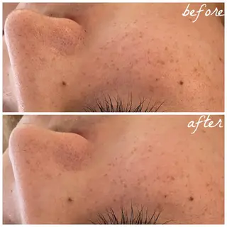 メンズ メナード岐阜市茜部 杉浦のエステ・リラクイメージ