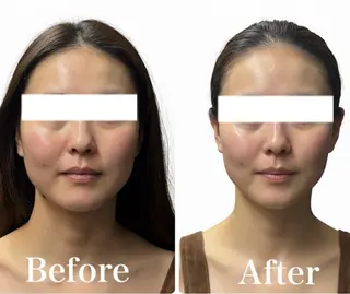 💎小顔ｻﾛﾝ アリリン銀座💎のエステ・リラクイメージ