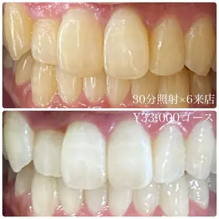 PLATINUM Beauty 横浜店所属・ホワイトニングルーム 横浜店のその他イメージ