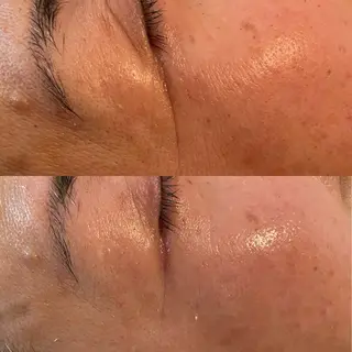 エステティックサロン Liente(リアンテ)所属・Hashimoto .のエステ・リラクイメージ