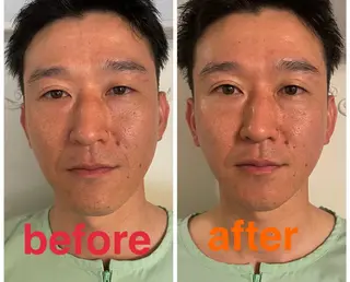 美容鍼灸サロン mahoroba院長のエステ・リラクイメージ