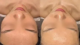 Le cherienのエステ・リラクイメージ