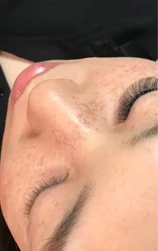 マツエク・マツパ アイラッシュ＆フェイシャルサロン　ベアトリーチェ所属・医療提携美容サロン Beatriceのエステ・リラクイメージ