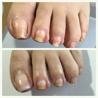 ネイル Nails  Ren salon&school所属・Nails Ren 山口のネイルデザイン