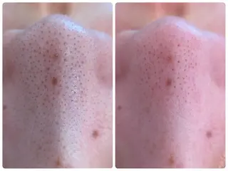 Hisui 小出のエステ・リラクイメージ