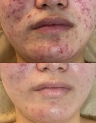 KiraBelle 佐々木 智美のその他イメージ