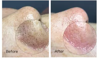 Frele Komiのエステ・リラクイメージ