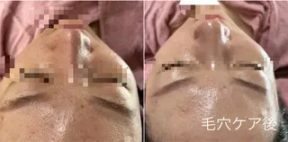 エステサロン藍月所属・エステサロン 藍月レイクタウンのエステ・リラクイメージ