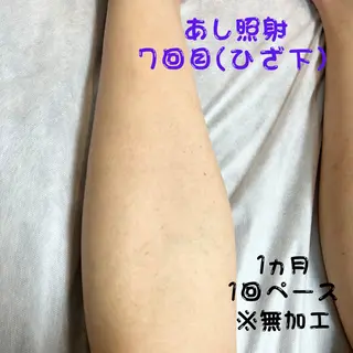 メンズ キッズ メンズ脱毛　FELISSE【フェリッセ】所属・メンズ脱毛フェリッセ /男女🆗キッズ🆗のエステ・リラクイメージ