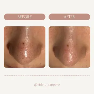 【vidyto】ヴィディトゥ所属・肌管理サロン vidyto　MOEのエステ・リラクイメージ