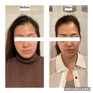 12Dハイフ💗 最強小顔のエステ・リラクイメージ