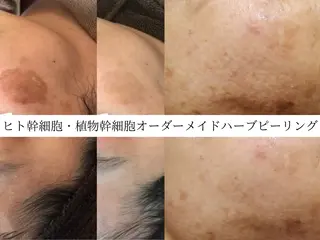 Rairy所属・Rairy Salon富士見町のエステ・リラクイメージ