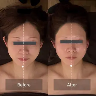 LANI所属・小顔専門サロン MAIのエステ・リラクイメージ