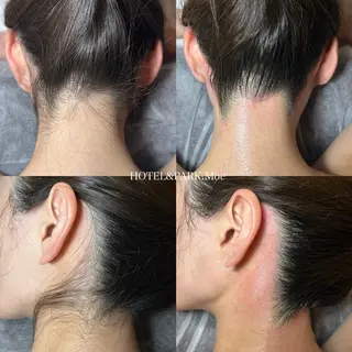 HOTEL&PARK .Moeワックス脱毛のエステ・リラクイメージ