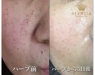 オールハンド フェイシャルのエステ・リラクイメージ