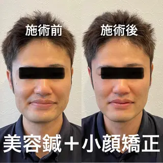 つばさ所属・マッツンの 鍼のその他イメージ