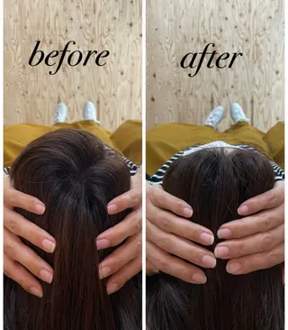 ate'所属・個室ドライヘッドスパ 🍃moriのエステ・リラクイメージ