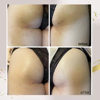 ピーリング専門店 Belluteのエステ・リラクイメージ