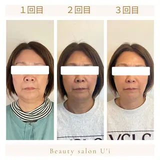 頭蓋骨小顔矯正 藤本のエステ・リラクイメージ