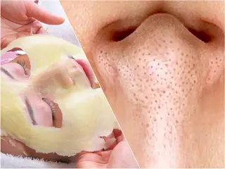 ミディアム パーマ ヘアアレンジ 四つ星サロン🎖 腸＆ニキビケアに特化のエステ・リラクイメージ