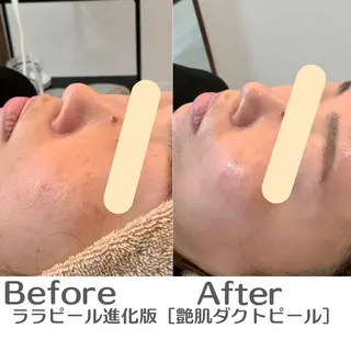 最速小顔・肌管理 espoirのエステ・リラクイメージ